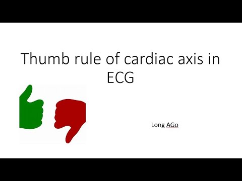 Thumb rule of cardiac axis in ECG