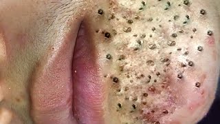 𝐶𝑙𝑒𝑎𝑛𝑖𝑛𝑔 𝑎𝑛𝑑 𝐵𝑒𝑎𝑢𝑡𝑖𝑓𝑖𝑐𝑎𝑡𝑖𝑜𝑛 𝑀𝑜𝑡𝑖𝑣𝑎𝑡𝑖𝑜𝑛 #34915