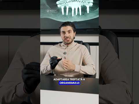 Dr Mitachi Dinti temporari pe implante