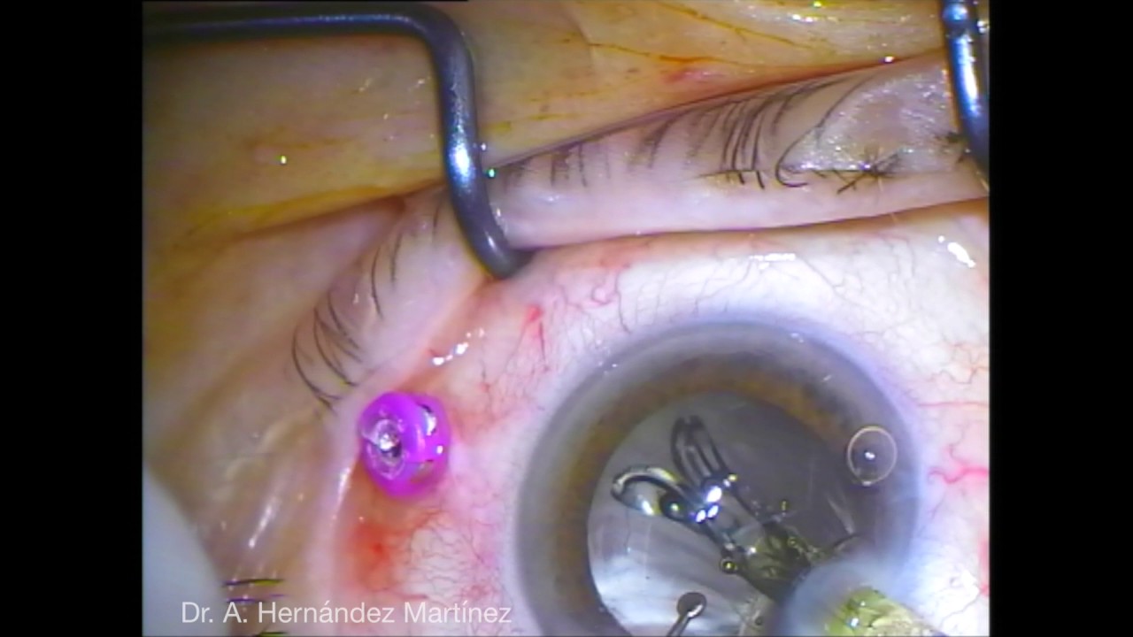 Adrián Hernández Martínez-12