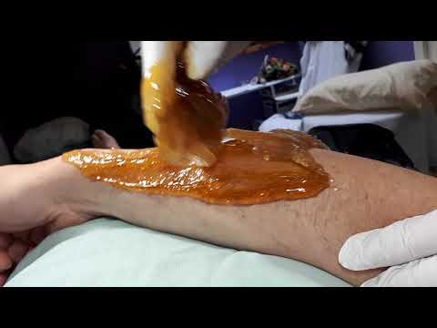 Sugaring a man's arm