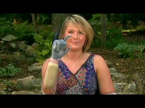 The Incredible Bionic Hands of Aimee Copeland