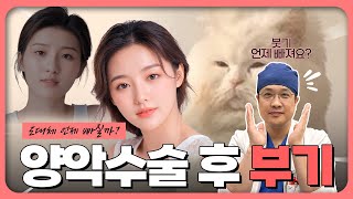 양악수술 후 부기 도대체 언제 빠질까?