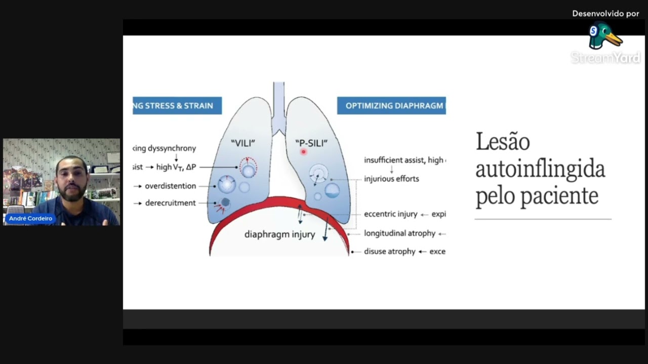 VILI - LESÃO PULMONAR INDUZIDA PELO VM