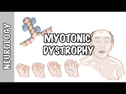 Myotone Dystrophie - Anzeichen und Symptome, Pathophysiologie, Behandlung