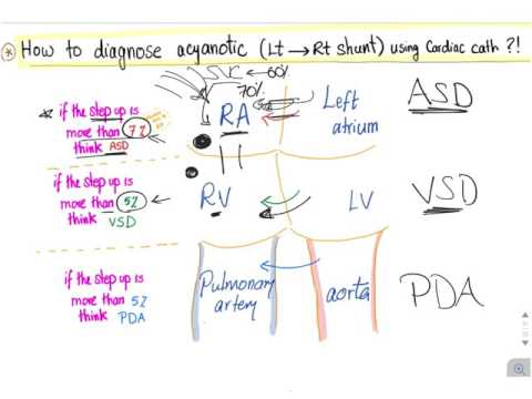 How to diagnose acyanotic heart diseases (Left to Right shunt) via Cardiac Catheterization.