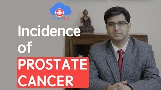 Incidence of prostate cancer