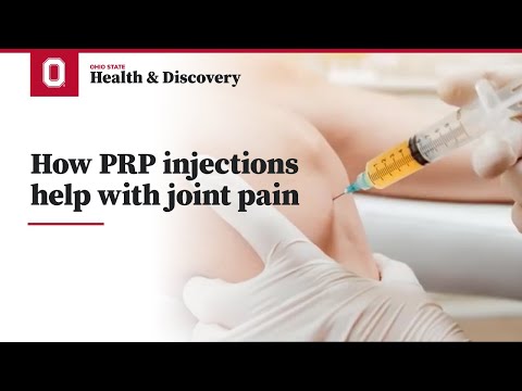How PRP injections help with joint pain | Ohio State Medical Center