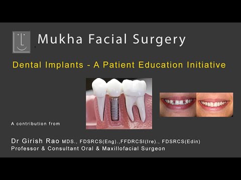 DentalI Implants - A Patient Education Initiative by Mukha Facial Surgery & Dental Implant Center