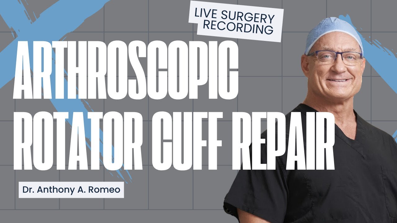 Arthroscopic Rotator Cuff Repair, Acromioplasty, and Biceps Tenodesis