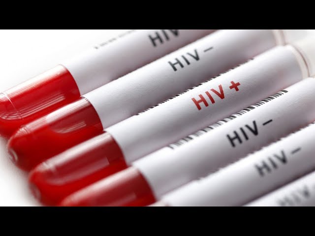 ВИЧ в Ангарске болен каждый 45  житель