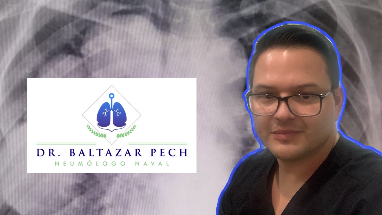 Baltazar Pech Alonso-19