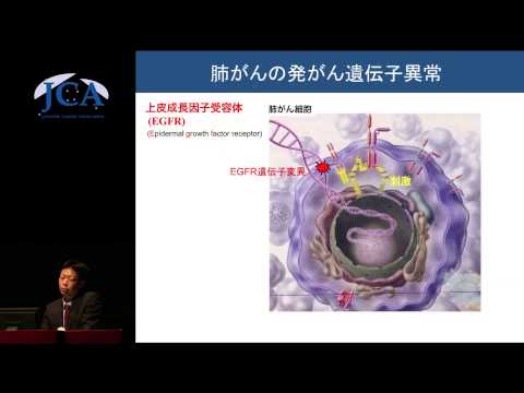 栄養学科 講演2「肺がんの分子標的治療はここまで進んでいる！」 矢野　聖二（金沢大学がん進展制御研究所　腫瘍内科　教授）