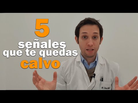 Conoce Las Principales Señales Que Te Alertan De Calvicie