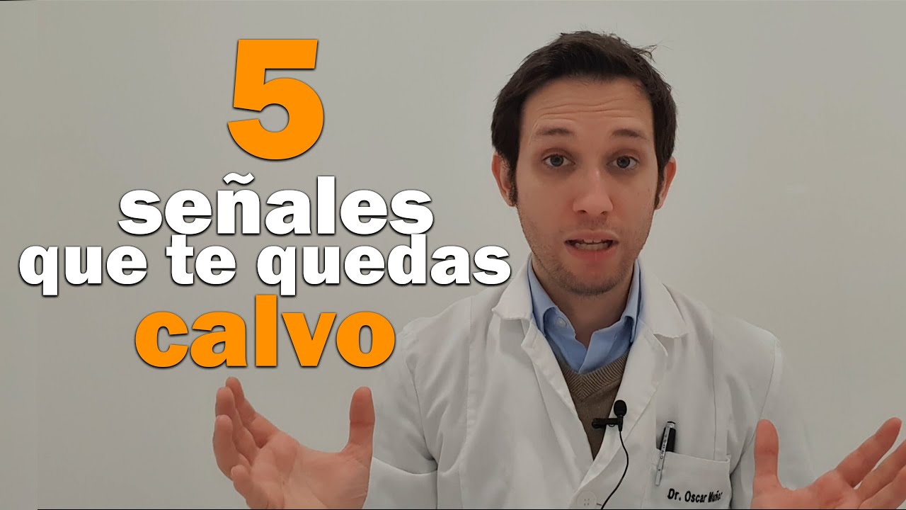 5 SEÑALES que TE vas a QUEDAR CALVO