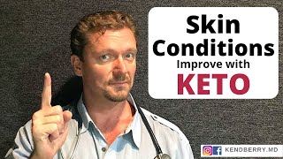 9 Skin Conditions KETO Improves - 2024 (Acne, Eczema, Psoriasis, and...)