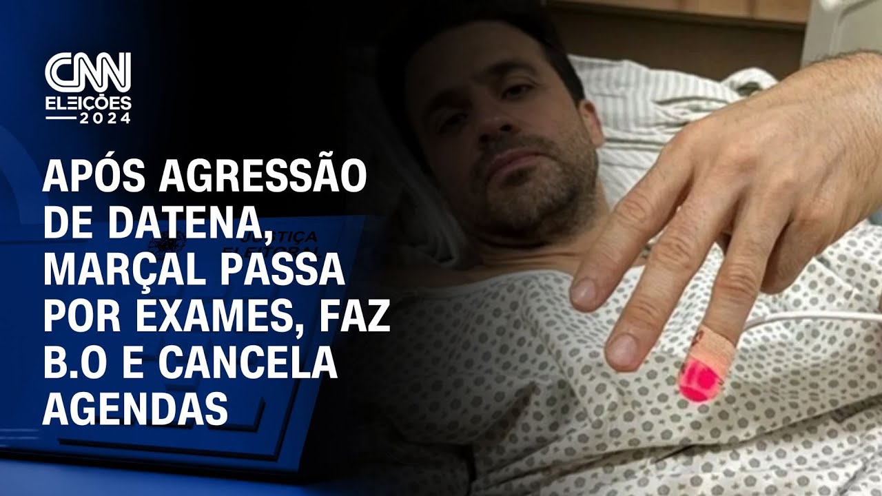 Após agressão de Datena, Marçal passa por exames, faz b.o e cancela agendas | LIVE CNN