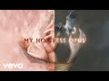 Imagine Dragons - Hopeless Opus (Official Lyric Video)