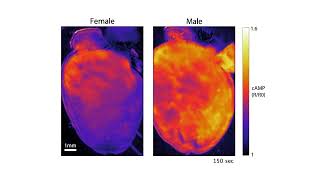 Newswise:Video Embedded female-and-male-hearts-respond-differently-to-stress-hormone