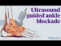 Ultrasound Guided Ankle Block