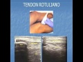 Eco Rodilla Part 1