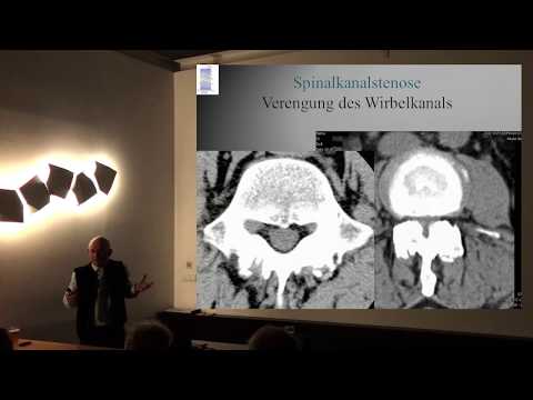Bewegungstherapie bei Arthrose der Kniegelenke Gelenkschmerzen Schwangerschaft Finger