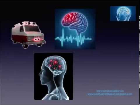 Stroke Awareness video