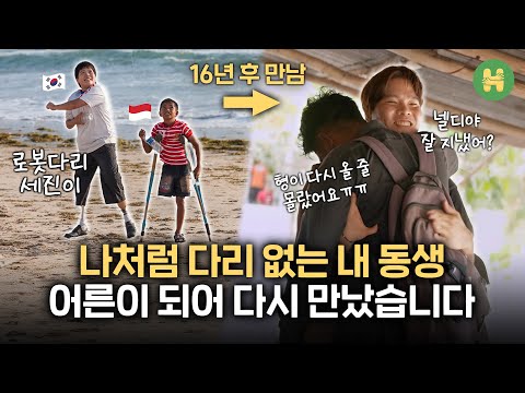 16년 전 내 '로봇다리'를 물려받은 동생의 대학 졸업식 | 어른이 된 '로봇다리 세진이' 근황