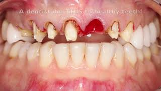Toxic Tuesday:  To save your teeth and health, READ THIS STORY!