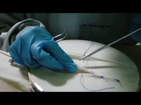 Punto de Sutura: Blair Donati