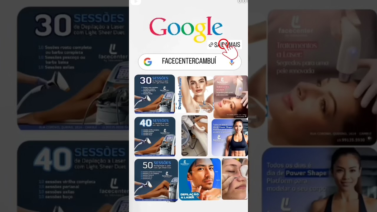 Depilação a laser com Light Sheer Duet  #depilacaoalaser https://depilacaoalasercampinas.com.br