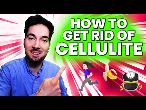 How To Get Rid Of Stretch Marks Removal and Treatment