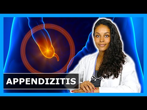 BLINDDARMENTZÜNDUNG ERKENNEN: SYMPTOME, TIPPS & OPERATION am Blinddarm bei Appendizitis