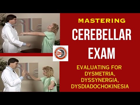 Mastering The Cerebellar Exam - Evaluating for Dysmetria, Dyssynergia, Dysdiadochokinesia
