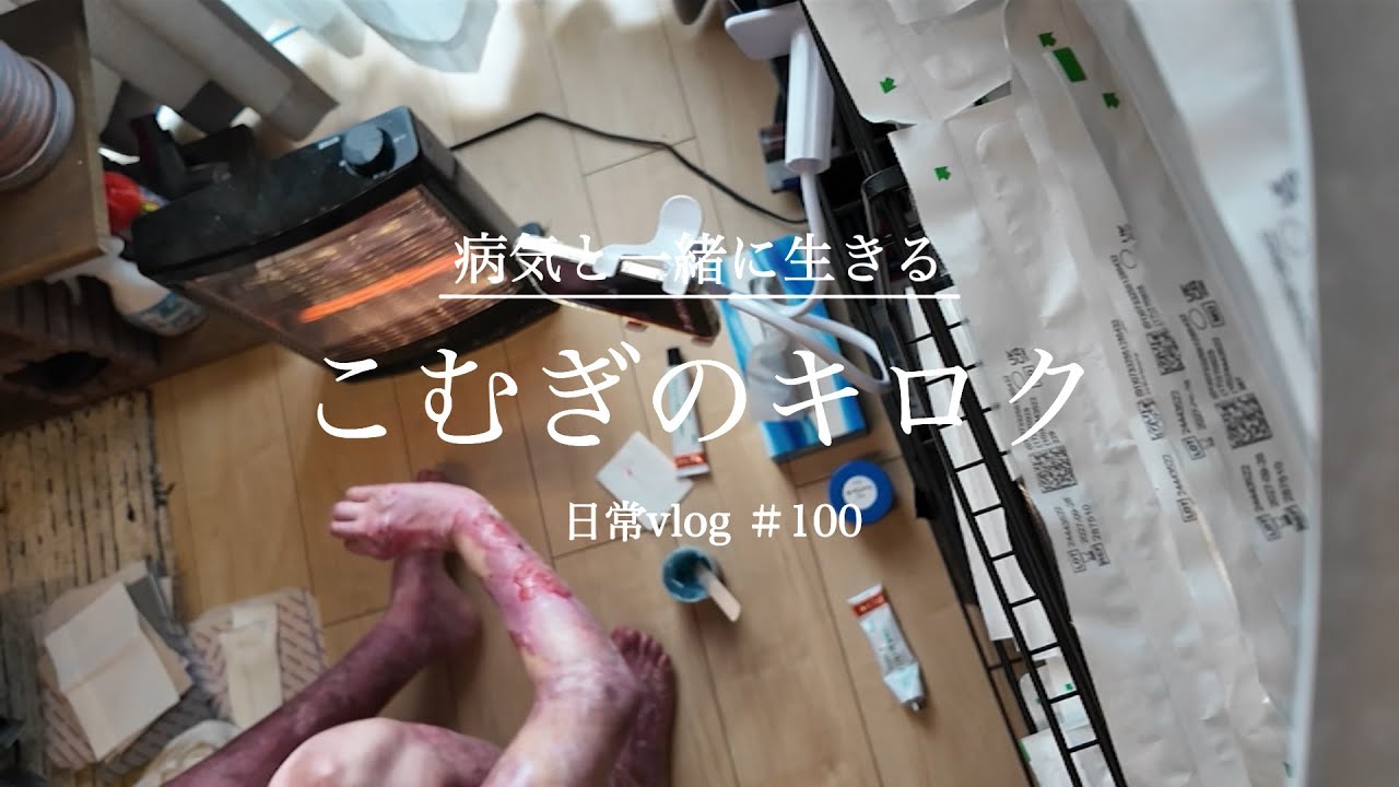 【表皮水疱症】ちょっと調子がいい時の理想の1日の流れ　日常vlog＃100【㊗️100回目！】