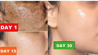 HOW I GOT RID OF ROUGH, DULL TEXTURED SKIN, CLEAR PIGMENTATION ON SKIN FAST, GET SMOOTH CLEAR SKIN