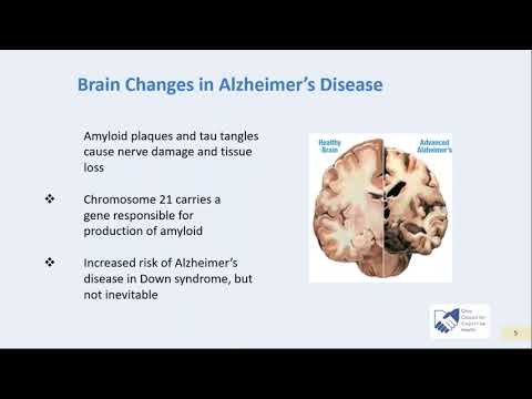 Dementia: NOT a Normal Part of Aging