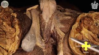 E5.1 | Mostración cadavérica: Periné masculino | Anatomía 2 | FMed UBA