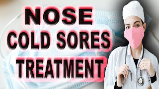 nose cold sores treatment