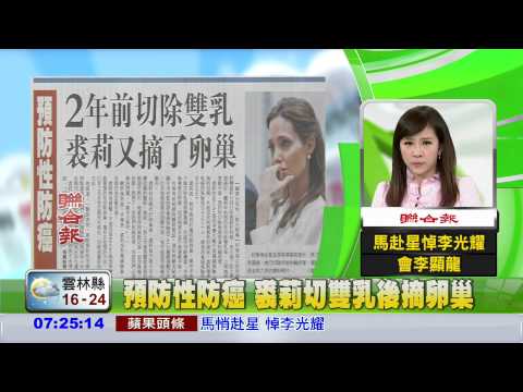 預防性防癌 裘莉切雙乳後摘卵巢