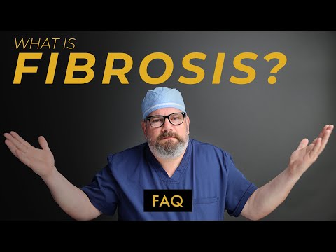 What Can You Do To Prevent FIBROSIS After Liposuction?