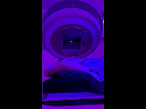 New Linear Accelerators Make Radiation Therapy Fast and Painless