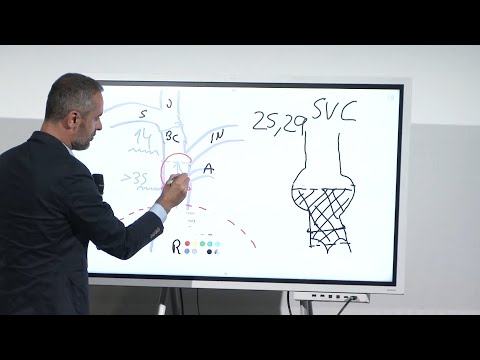 Heterotopic tricuspid valves: to who, when and how? - EuroPCR 2024