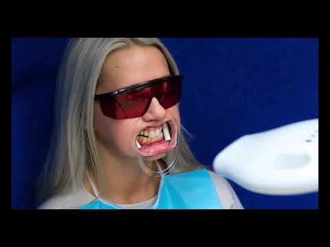 Bleaching Dübendorf | Zahnaufhellung beim Zahnarzt in Dübendorf ZH