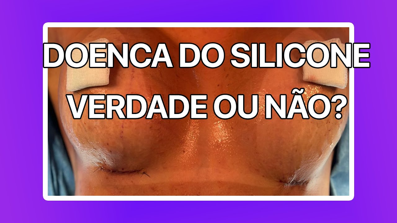 DOENÇA DO SILICONE VERDADE OU NÃO? CIRURGIA PLÁSTICA