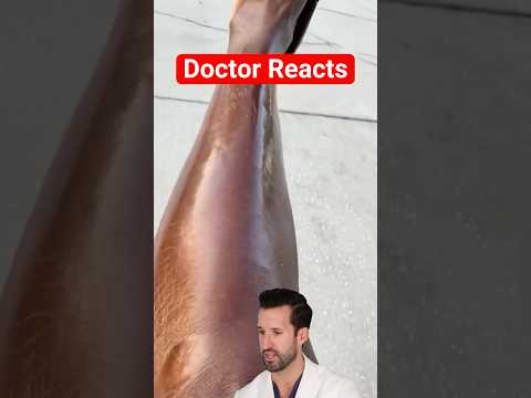 ER Doctor REACTS to "Shiny Skin"