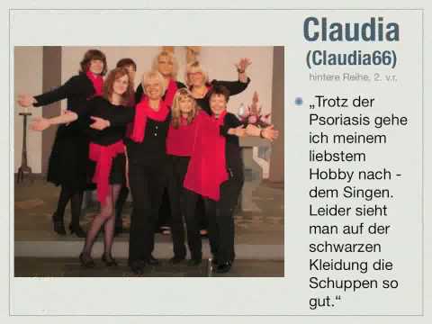 Das Ekzem auf der Hand mit dem Anbruch Atopitscheski die Hautentzündung beim Erwachsenen, wie zu heilen