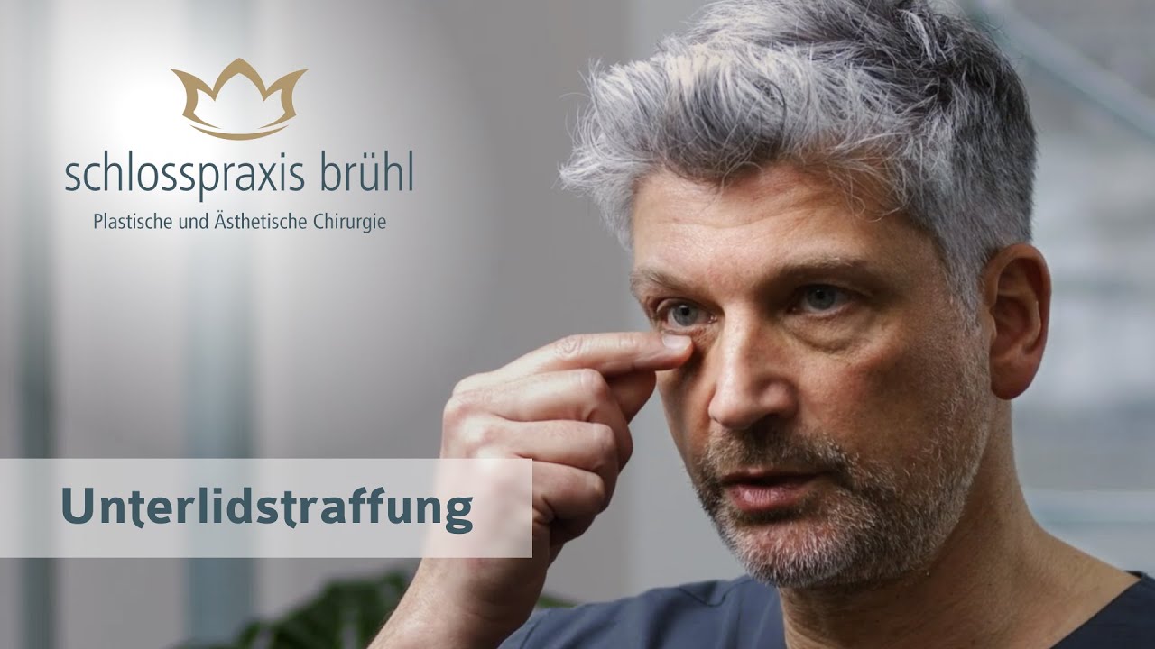 Achmed Tobias Scheersoi-14