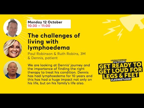 The challenges of living with lymphoedema