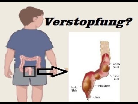 Ätiologie und prädisponierende Faktoren von Diabetes Gliatilin und Diabetes